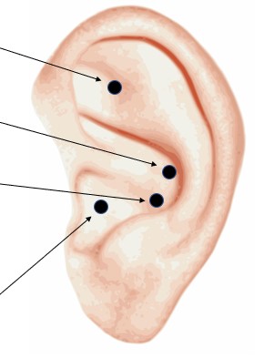 DIY Ear Seeds for Anxiety | Many Rivers Community Acupuncture